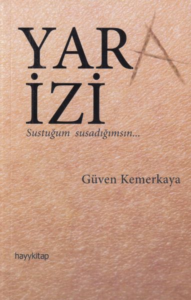 Yara İzi-zoom-