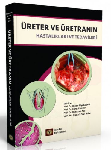 Üreter ve Üretranın Hastalıkları ve Tedavileri-zoom-