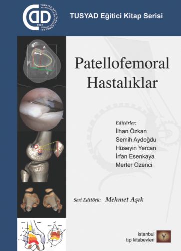 TUSYAD Eğitici Kitap Serisi - Patellofemoral Hastalıklar-zoom-