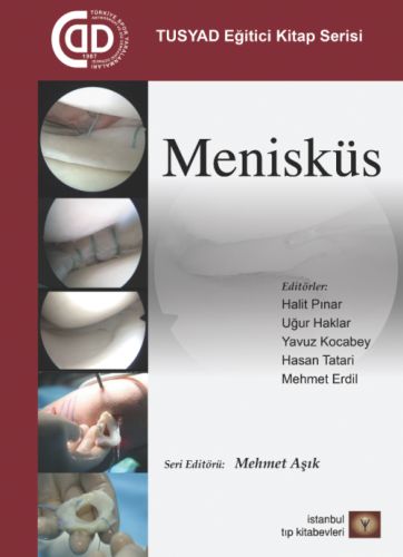 TUSYAD Eğitici Eğitim Seti - Menisküs-zoom-